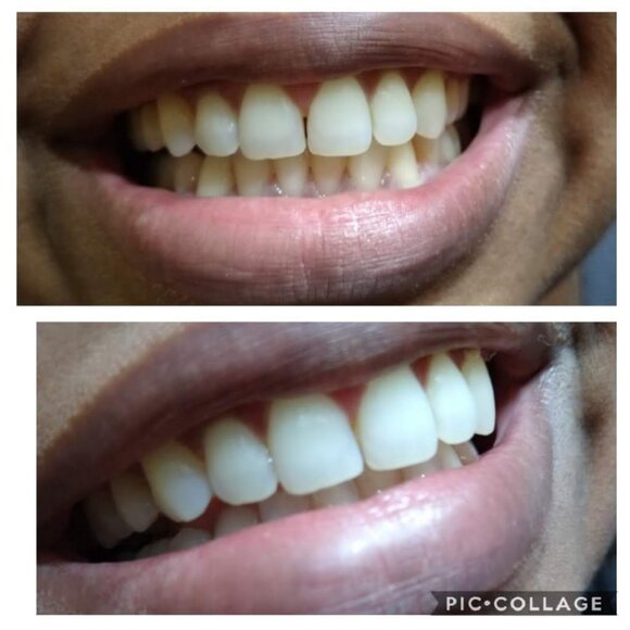 NuSkin Whitening Toothpaste (2-pack) - Picture 2 of 3